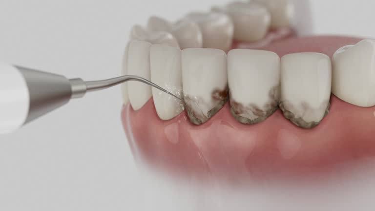Reliable Invisalign Clear Aligners contractor in Ravalli County County, MT by Dentist Open Now
